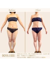 マクイエステティック 表参道店/30代ビフォーアフター