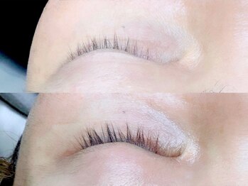 エレノアビューティー(Eleanor BEAUTY)/エグータム3ヶ月使用後