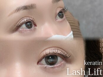 ディッチャ(Dicha)/◇ラッシュリフト◇