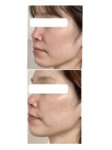 ロゼブランシュ(Rose Blanche)/