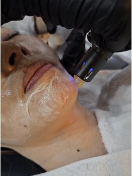 レミューズ(LES MUSES)の写真/【話題のボニックス　メソスキンカラー導入　ノーファンデでも艶美肌◎】