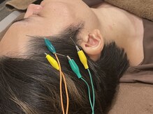 高田馬場はりきゅう院/頭痛への鍼灸