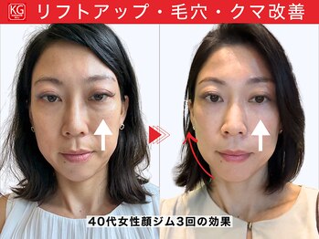 顔ジム 麻布店/40代女性顔ジム継続の効果