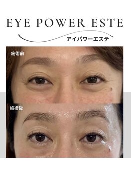 ラフィーユ 南風原店(Lafille)の写真/【目元悩みケア専門店】ラフィーユでは、目元悩みに特化したアイパワーエステをご提供しております♪
