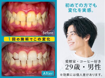 ホワイティア たまプラーザ(WhiTeA)の写真