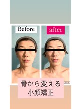 ビチル 薬院(美chill)/骨から変わる小顔矯正
