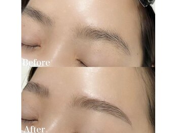 レピア 高槻店/韓国式LEPIA Before&After