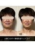 【黄金バランスがコルギで叶う☆小顔リフト】小顔コルギ＋ヘッドスパ(70分)