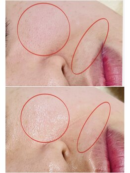 プチ プロムナード(Petit Promenade)/美肌フェイスワックス