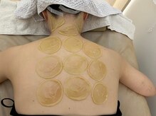 シュエットサロン 自由が丘(Chouette Salon)/背中の松ヤニパック