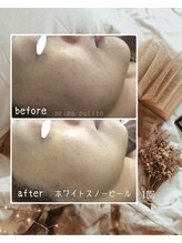 プリマプリート 各務原店/白玉ホワイトスノーピール