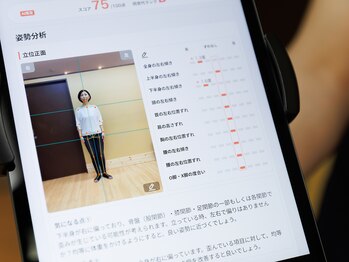 さいわい整骨院/ＡＩ姿勢診断