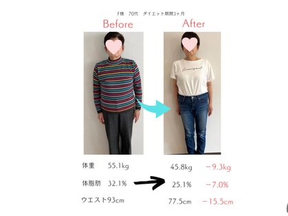 トゥインクル(twinkle)の写真