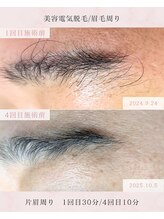 マロウド(malowdo)/眉毛脱毛できます。