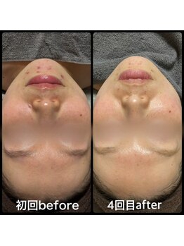 クリアボックス(Clear box)/【ララピール】