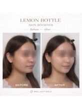 ブリリアントスマイル/レモンボトルスキンブースター