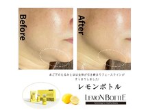 ミール(Meel)の雰囲気（小顔の効果絶大◎）