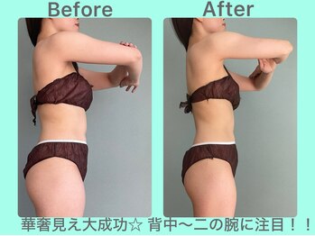 ビーナイス ビューティー(Be Nice Beauty)/上半身パイラソード3回