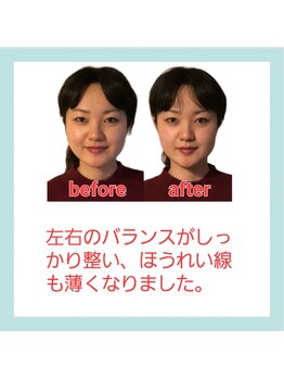 りんぱサロン まり/お客様のbefore→after