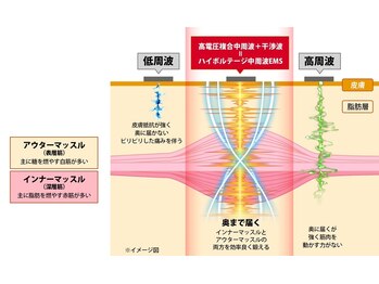 リ シェリール(Re cherir)/ハイボルテージ