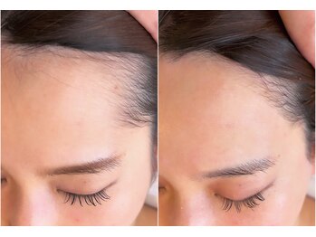 サロン エデンプラス(salon eden PLUS)/フェイシャルワックス