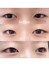 ステラネイルズ(Stella nails)/まつ毛パーマ経過