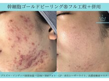 リメイククリニカルビューティー(Remake clinical beauty)/唯一無二の施術