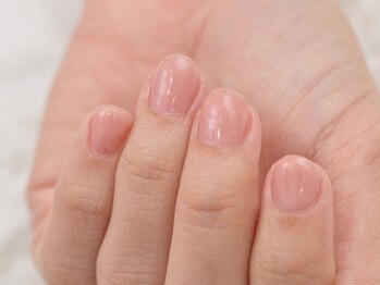グレースレディ 大阪店の写真/専門技術で爪の悩みを解消！深爪矯正、長さだし、フィルインが得意なサロン☆まずはお気軽にご相談ください