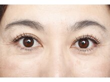 アンジェリック 上野マルイ店(Angelic)/40代アフター写真