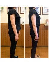 リンドール(RinDoll)/50代女性ダイエット/耳ツボ/痩身