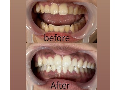 アイネイルサロン(i nail salon)の写真