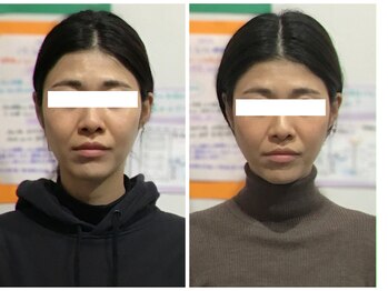 シンメトリー 麻布十番/Before/After