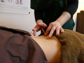 ひなた鍼灸整骨院 大類院の写真/局所・半身・全身・美容と豊富なメニューでお身体の状態やご希望に合わせて施術◎初めての方もお気軽に♪