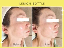 シロカネ イオンタウン西熊本店(SHIROKANE)/レモンボトル☆