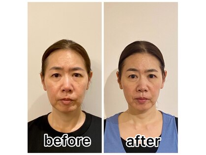 フロイデ(Freude)の写真