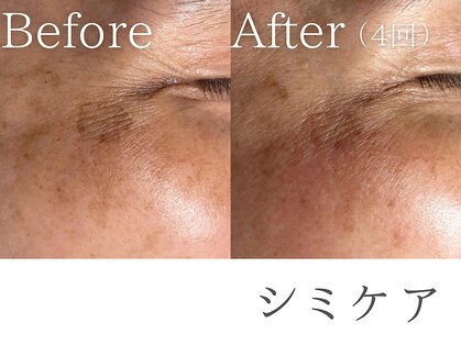 レイミー(reimee)の写真