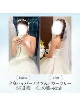 エスプレッソ(espresso,)/【花嫁様】二の腕マイナス4cm