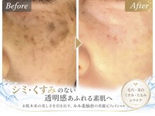 ルル 北仙台の雰囲気（レーザーを使わずシミケアお肌に傷やダメージのない自然療法◎）