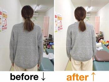 健康工房たいよう整骨院/猫背矯正、骨盤矯正