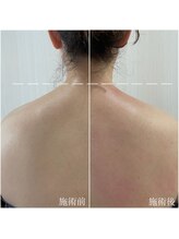 サロン ブーケ(Salon Bouquet)/軽い肩を手に入れてください！