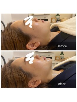 ウィズ ユー ビューティ(with U beauty)/お顔も一度でスッキリ♪