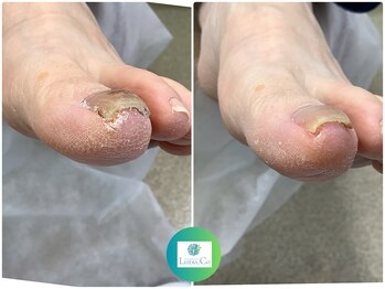 リゼラアンドコー たまプラーザ店/ネイルキュアコース