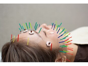 メディカルジャパン 国分寺/美容鍼