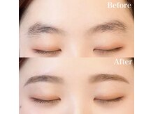 レピア 高槻店/韓国式LEPIA Before&After