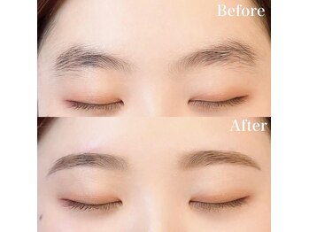 レピア 高槻店/韓国式LEPIA Before&After