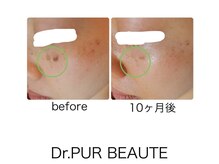 イスタナ ロゼ/Dr.PUR BEAUTE