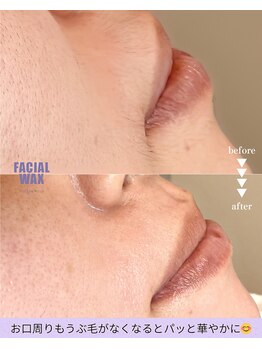 リバース(waxR B S)/口元のうぶ毛も綺麗に♪