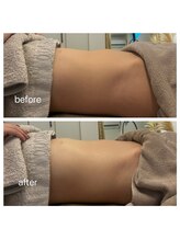 美温(mion)/腸活　ライン出し