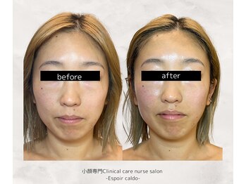 エスポワールカルド(Espoir caldo)/