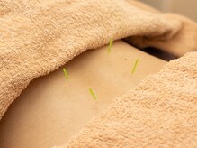 なべ鍼灸院/鍼灸